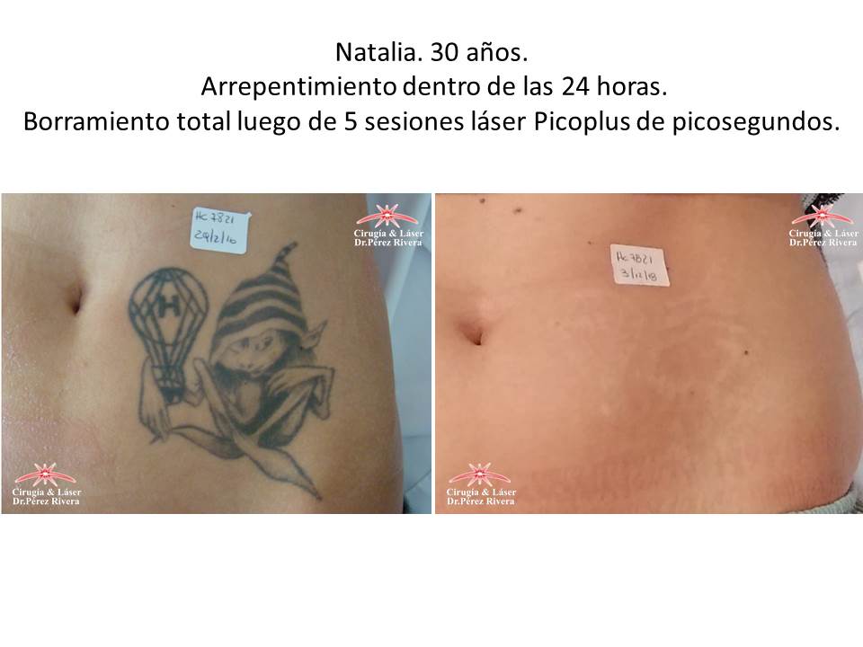 Todos tenemos derecho de arrepentirnos